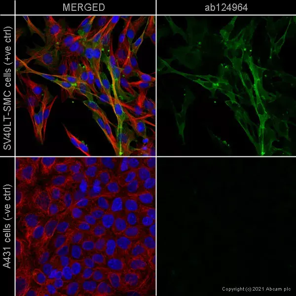 Anti-alpha smooth muscle Actin antibody [EPR5368](AB124964)