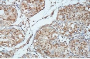 Magi3 Antibody Ab118615  Immunohistochemistry Formalin Pfa Fixed Paraffin Embedded Sections Img110366