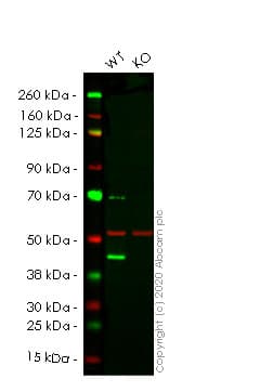 Anti-Glutamine Synthetase antibody [EPR16661](AB197024)