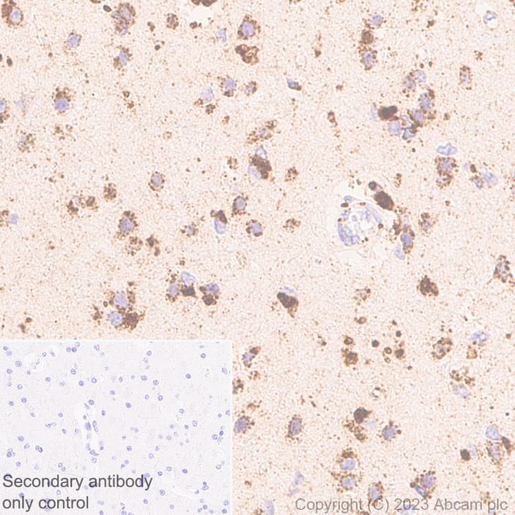 Limpii Antibody Epr26243 125 Ab314217  Immunohistochemistry Formalin Pfa Fixed Paraffin Embedded Sections Img421583