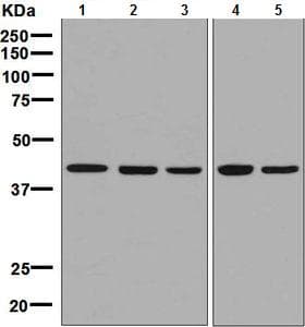 Anti-NK-p44 antibody [EPR5060(2)](AB133668)