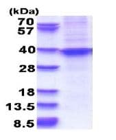 Ab180306  Sds Page Img98775