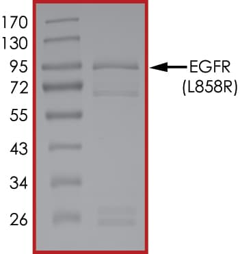 Recombinant human EGFR (mutated L858R) protein (Active)(ab268502)