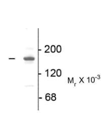 Anti-NMDAR2A antibody(AB169873)