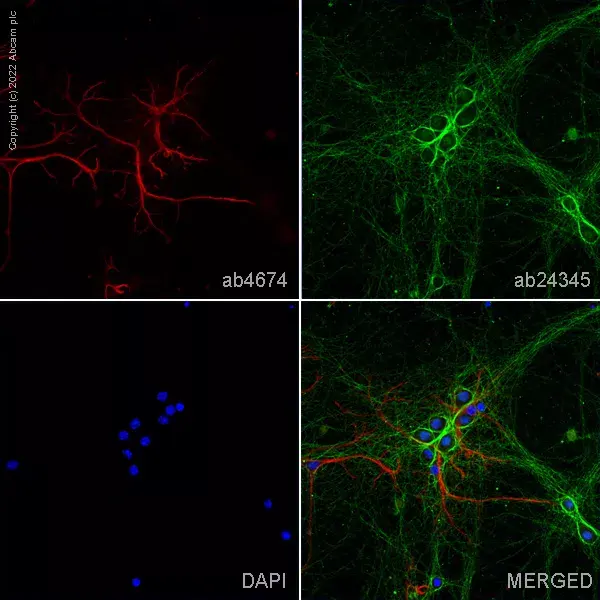 Anti-GFAP antibody(AB4674)