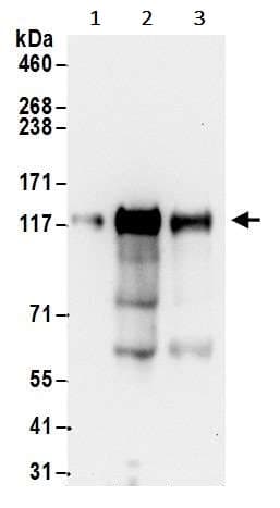Anti-ROR2 antibody(AB245456)