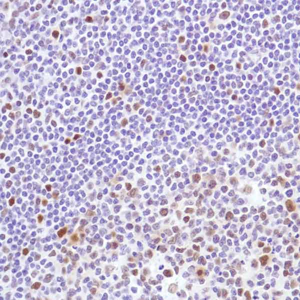 Anti-Cyclin D3/CCND3 antibody [SP207] - BSA and Azide free(AB245734)