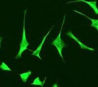 Rbp4 Antibody Ep3657 Ab109193  Immunocytochemistry Immunofluorescence Img68815