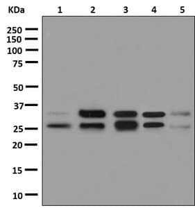 Tip30 Antibody Epr13185 Ab181378  Western Blot Img105013