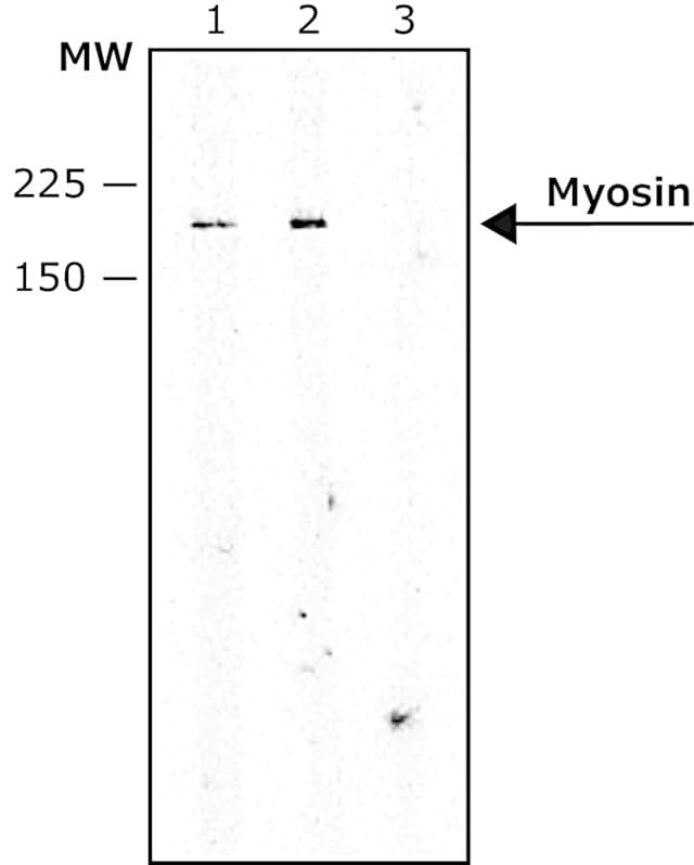 Anti-Slow Skeletal Myosin Heavy chain antibody [NOQ7.5.4D](AB11083)