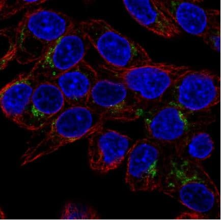 Anti-GDF15 antibody(AB211364)