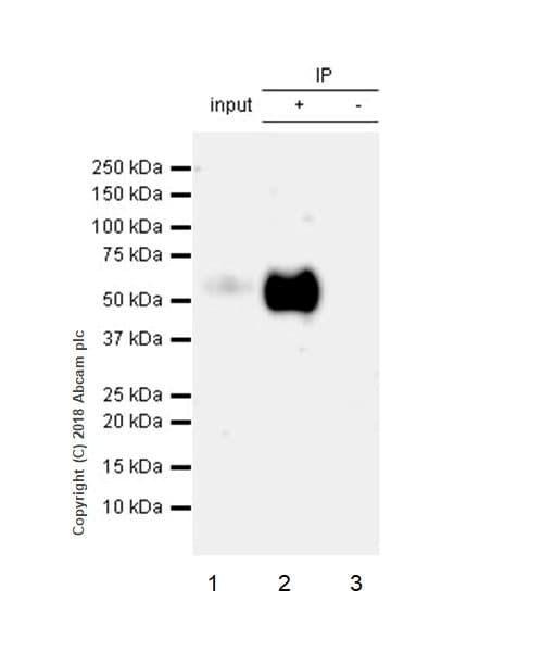 Anti-Tau (phospho S396) antibody [EPR2731](AB109390)