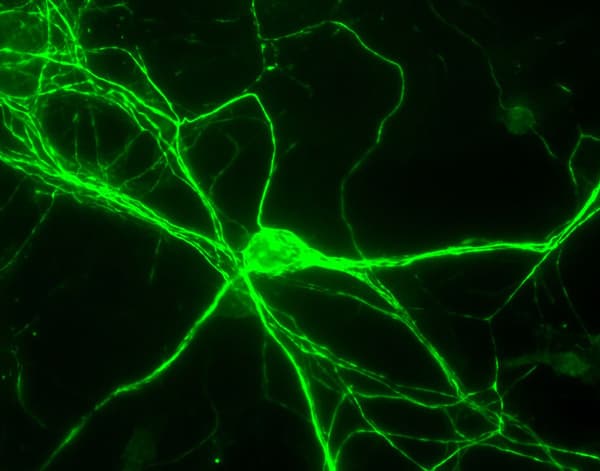 Anti-Neurofilament heavy polypeptide antibody(AB4680)