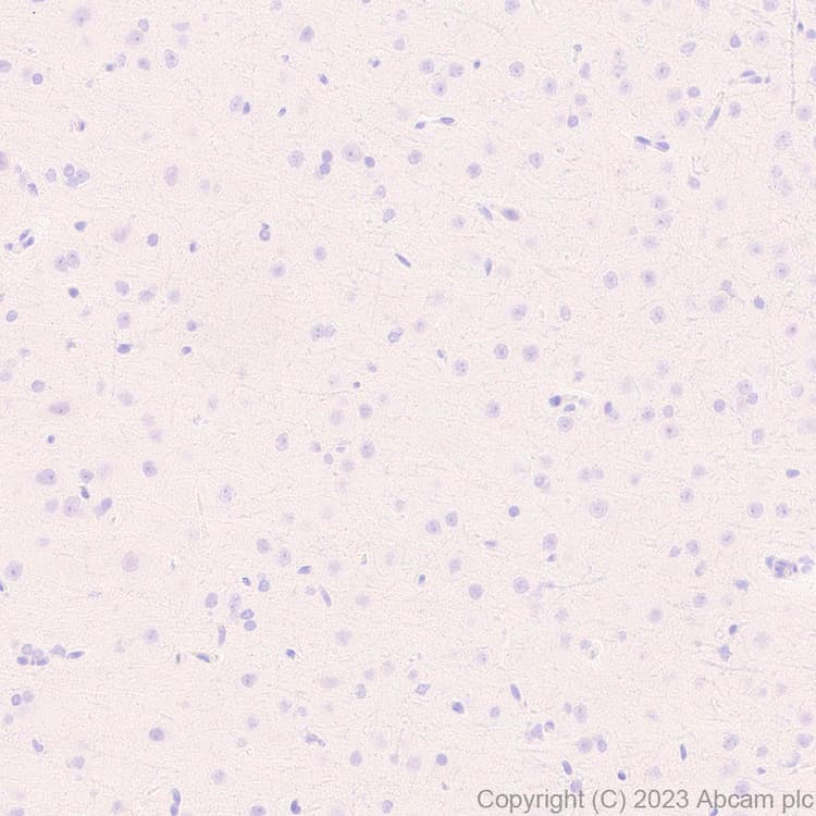 Anti-Neutrophil Elastase antibody [EPR28386-66](AB310335)