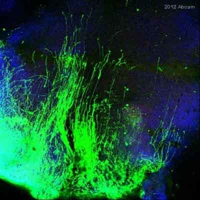 Anti-GFP antibody(AB5450)