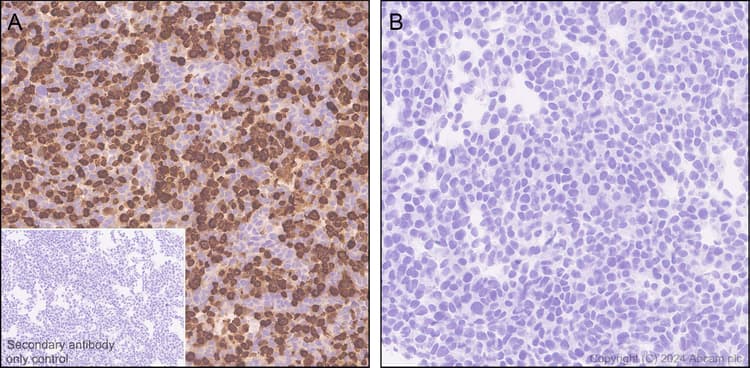 Anti-EBV Nuclear Antigen/EBNA1 antibody [EPR28706-78] - BSA and Azide free(AB316861)