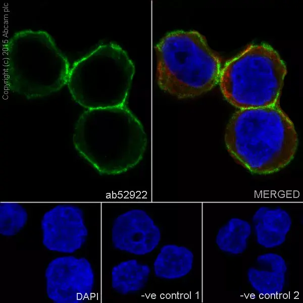 Anti-HLA A antibody [EP1395Y](AB52922)