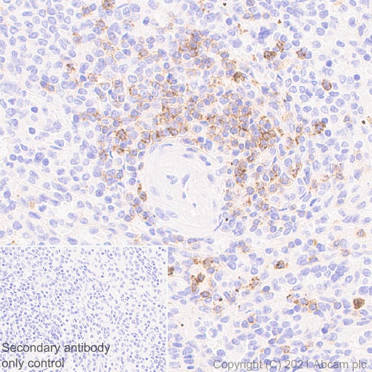 Cd127 Antibody Epr23747 333 Ab259806  Immunohistochemistry Formalin Pfa Fixed Paraffin Embedded Sections Img175778