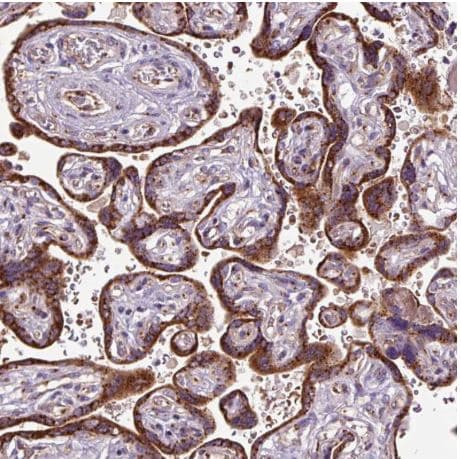 Msmp Antibody Ab185471  Immunohistochemistry Formalin Pfa Fixed Paraffin Embedded Sections Img67125
