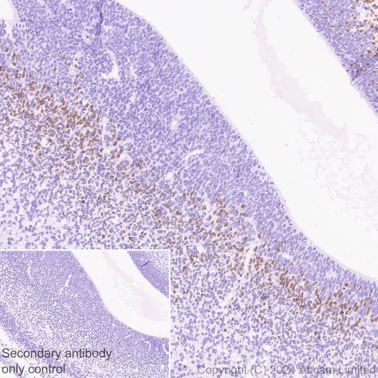 Anti-TBR2 / Eomes antibody [RM2055](AB319166)