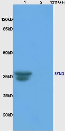 Anti-Cathepsin L/MEP antibody(AB203028)