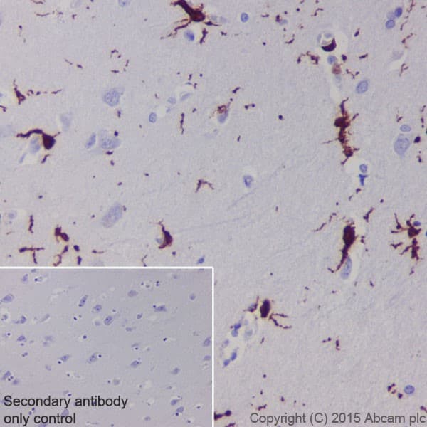 Anti-Iba1 antibody [EPR16589](AB178847)