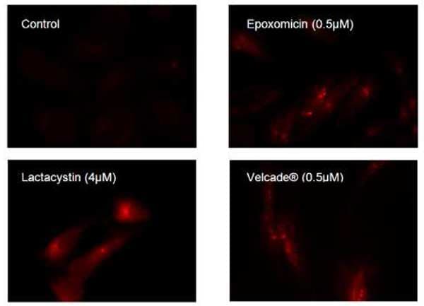 Aggresome Detection Kit(AB139486)