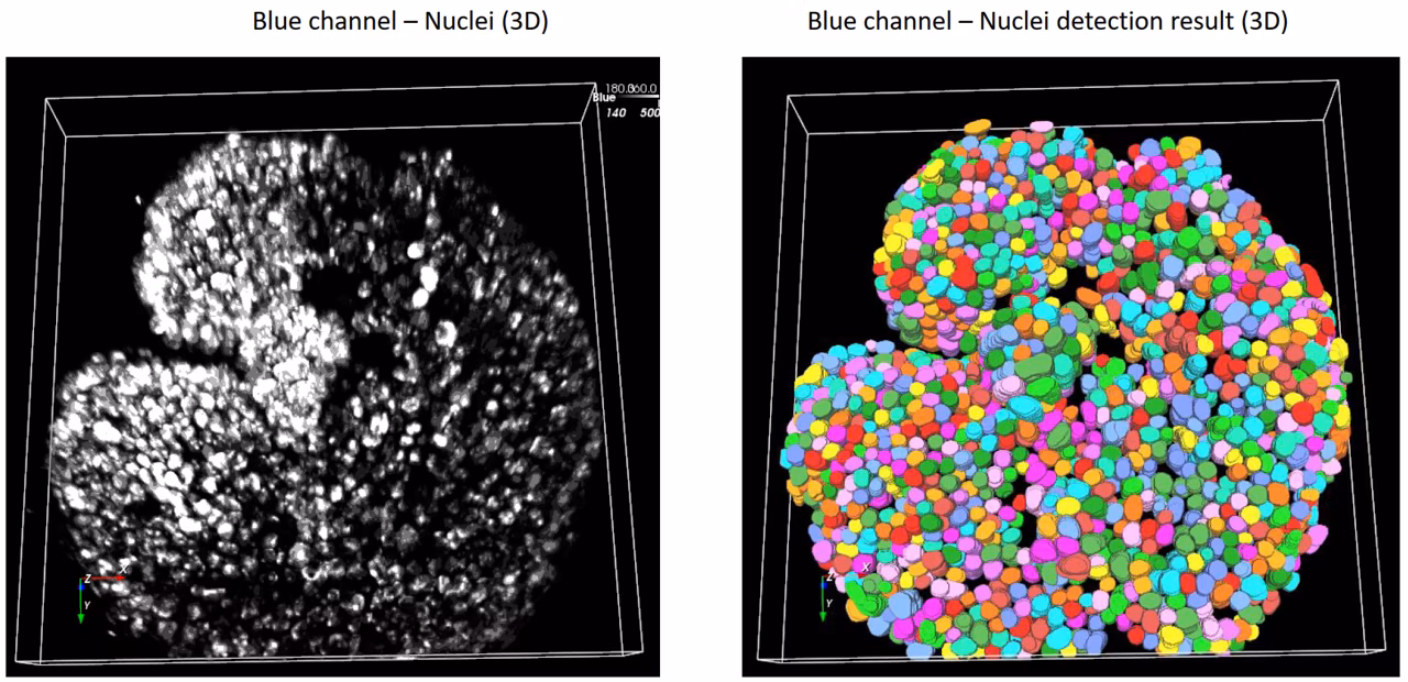 Aivia AI Image Analysis Software