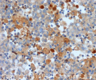 Mmp9 Antibody Ab73734  Immunohistochemistry Formalin Pfa Fixed Paraffin Embedded Sections Img127337