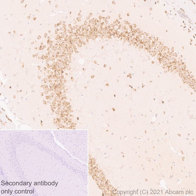 Scn1a Antibody Epr22326 112 Ab222091  Immunohistochemistry Formalin Pfa Fixed Paraffin Embedded Sections Img10826