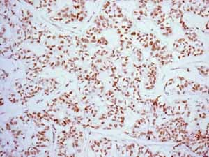 Anti-FOXP1 antibody [EPR4113](AB134055)