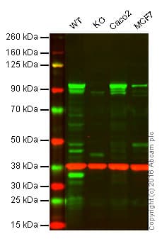 Anti-SUZ12 antibody [EPR5234(N)] - ChIP Grade(AB175187)