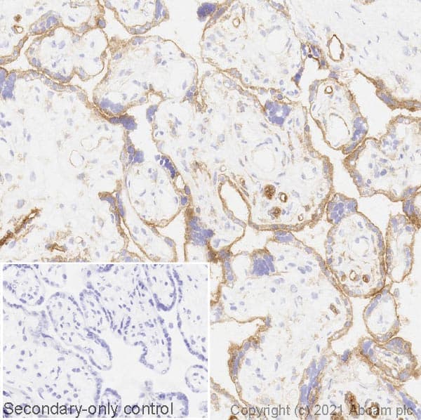 Cd39 Antibody Ac2 Ab97552  Immunohistochemistry Frozen Sections Img172179
