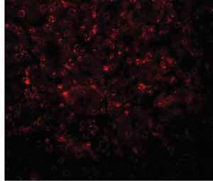 Slfn14 Antibody Ab106406  Immunocytochemistry Immunofluorescence Img60764