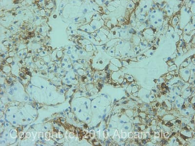 Neutrophil Marker (CD11b, CD16, CD32, CD44, CD55) Antibody Panel - Human(AB254016)