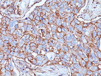 Cd44 Antibody 156 3c11 Bsa And Azide Free Ab213072  Immunohistochemistry Formalin Pfa Fixed Paraffin Embedded Sections Img139798