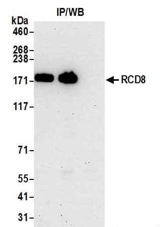 Edc4 Antibody Ab72408  Immunoprecipitation Img182277