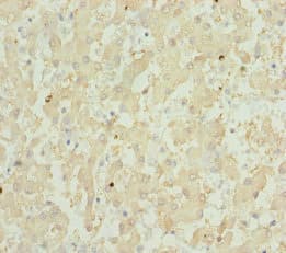 Gpx5 Antibody Ab230025  Immunohistochemistry Formalin Pfa Fixed Paraffin Embedded Sections Img36077