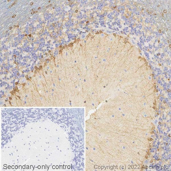Anti-Glutamine Synthetase antibody(AB73593)