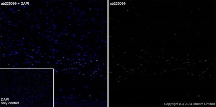 Alexa Fluor® 488 Anti-Olig2 antibody [EPR2673](AB225099)