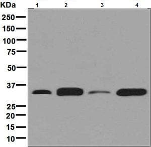 Anti-Syntenin antibody [EPR8102](AB133267)