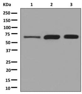 Anti-Klotho antibody [EPR6856](AB181373)