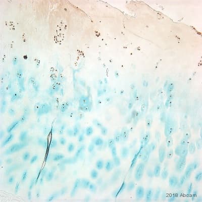 Anti-CDKN2A/p16INK4a antibody [2D9A12](AB54210)