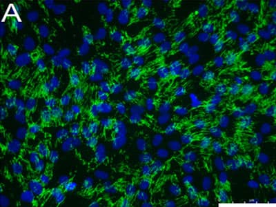 Anti-SSEA4 antibody [MC813-70](AB16287)