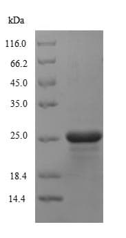 Recombinant Puromycin N-acetyltransferase protein (His tag)(ab236201)