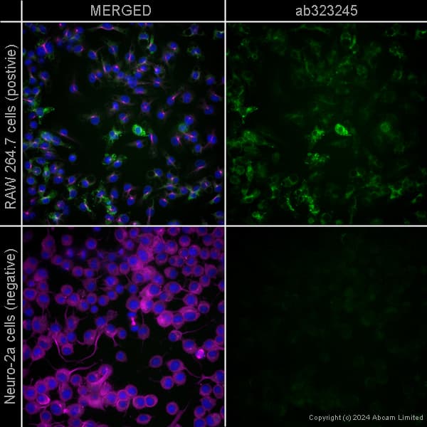 Rabbit Monoclonal H26 10 Human Igg1 H L Alexa Fluor 488 Ab200622  Immunocytochemistry Immunofluorescence Img440855