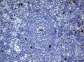 Anti-Ki67 antibody [OTI5D7](AB156956)