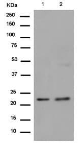 Lrrc20 Antibody Ep99772 Ab186416  Western Blot Img147054