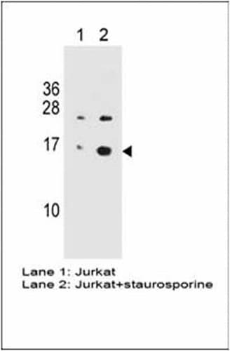 Anti-gamma H2A.X (phospho S139) antibody [3F2](AB22551)