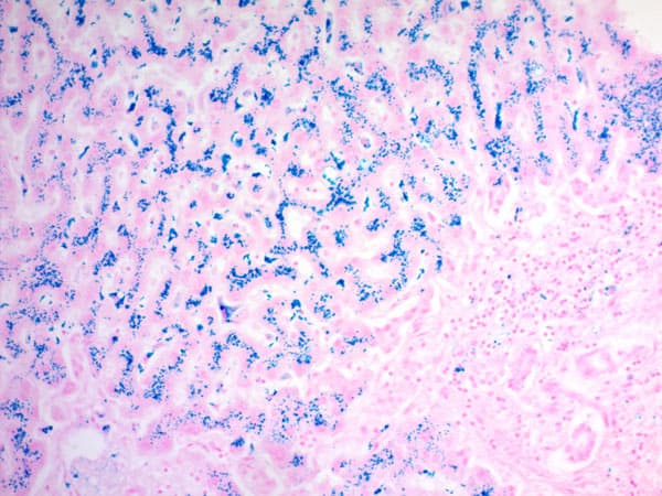 Iron Stain Kit (Prussian Blue Stain)(AB150674)